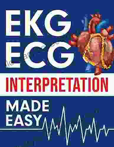 EKG ECG Interpretation Made Easy: An Illustrated Study Guide For Students To Easily Learn How To Read Interpret ECG Strips